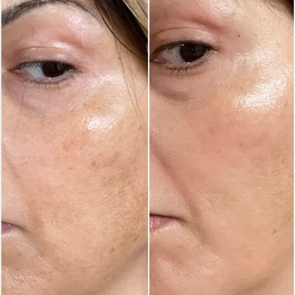 True Botanicals Phyto-Retinol Vitamin A Booster - 30 Capsules NIB Sealed - Picture 8 of 12